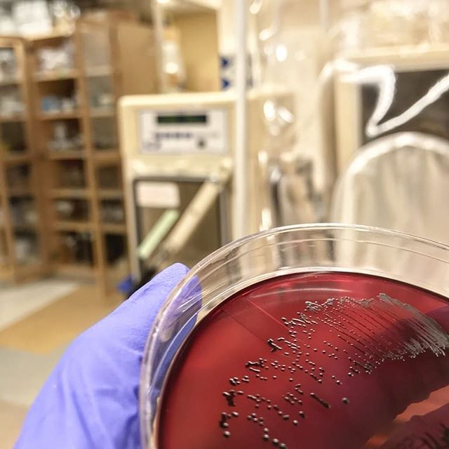 Racing to save our vanishing microbes