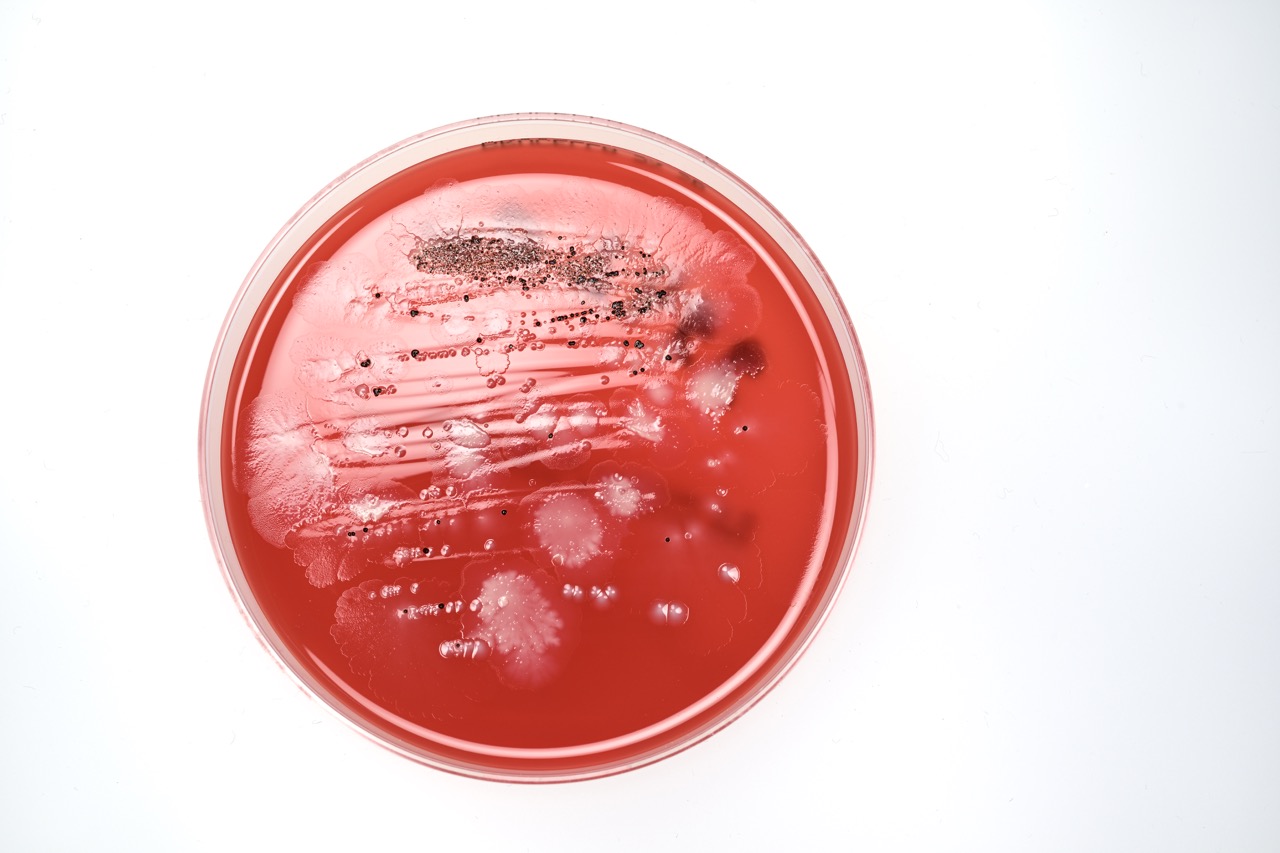Agar plate